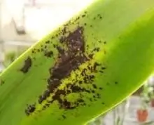 edema